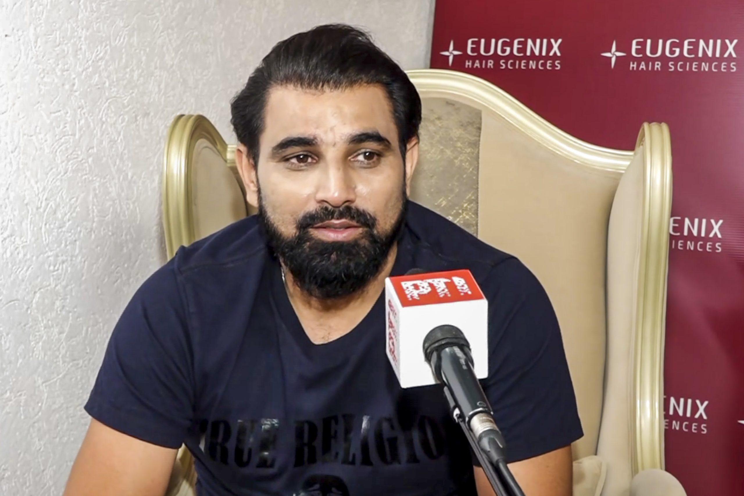 Shami’s return to competitive cricket delayed; not to play for Bengal against Karnataka, MP